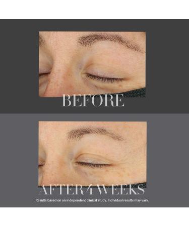 Kate Somerville KateCeuticals Lifting Eye Cream - Anti-Aging Treatment for Fine Lines & Wrinkles | 0.5 Fl Oz - Shop Internationally - Buy Online on GoSupps.com