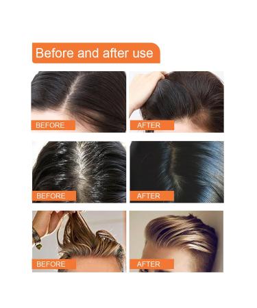 Buy Travel Size Dry Shampoo Powder - Non-Aerosol Volumizing for Men & Women | No White Cast Fuller Hair Boost | 0.3 Oz - Buy Online on GoSupps.com