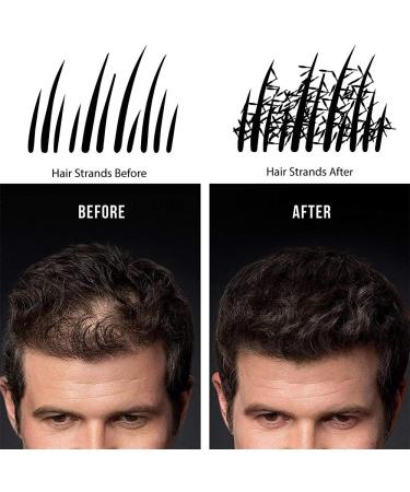 Hair Powder Densifying Powder Volume Brown Baldness Man Hair Building Fibers Dark brown  - Buy Online on GoSupps.com