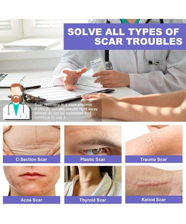 OK TAPE Silicone Scar Tape - Reusable Silicone Strips for Scar Removal (1.5 x 3.3 yards) | Burns, Surgery, Acne, Keloid, Injury - Buy Online on GoSupps.com
