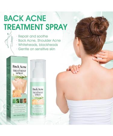  Miioto Back Acne Treatment Spray Back Acne and Chest Acne Removes Excess Oil on the Body and Penetrates Pores Soft and Non-Irritating 120ml - Buy Online on GoSupps.com