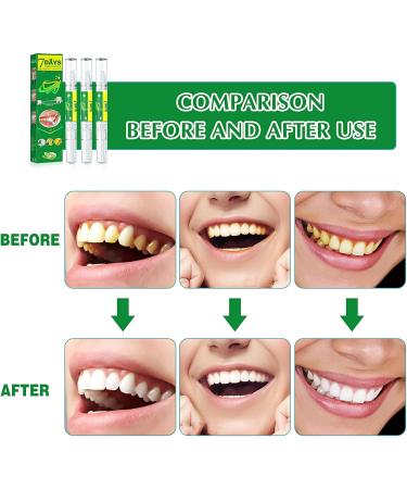 3-Pack Teeth Whitening Pen - Effective Stain Removal & Natural Tooth Lightening for Bright Smiles - Buy Online on GoSupps.com