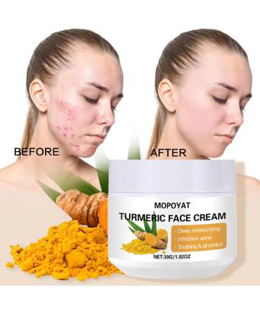 Turmeric Face Cream Face Moisturiser Anti Aging Cream for Radiant & Glowing Skin Dark Spot Corrector Remover for Face Natural Turmeric Cream Skin Care Moisturizing Erase Fine Lines Firming - Buy Online on GoSupps.com