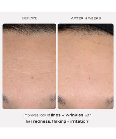 First Aid Beauty 0.3% Retinol Complex Serum with Peptides Reduce Wrinkles & Lines Gentle Formula 1 oz | International Shipping - Buy Online on GoSupps.com