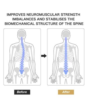 LOSCHEN Scoliosis Posture Correction Device | Adjustable Spinal Orthosis for Postoperative Recovery | Fits Waist Sizes 26-42 - Buy Online on GoSupps.com