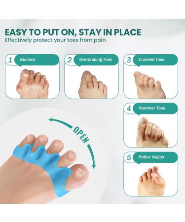 Welnove Toe Separators Bunion Correctors - 4 Pcs Gel Aloe Vera Infused | Overlapping & Hammer Toe Straighteners | Silicone Cushion for Yoga | Fits Women's 11+ & Men's 10 - Buy Online on GoSupps.com