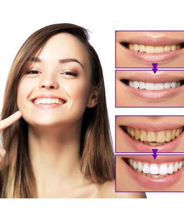 oihgerg Renhe Artisanal Toothpaste Probiotic Whitening Toothpaste Cavity Protection Fluoride-Free Protection for Sensitive Teeth and Gums (2pcs) - Buy Online on GoSupps.com