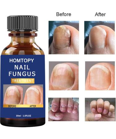 ARTBY Nail repair kit for cracked natural nail Nail repair kit for cracked natural nail Renewal Nail Repair solution for discolored and damaged nails Artiby - Buy Online on GoSupps.com