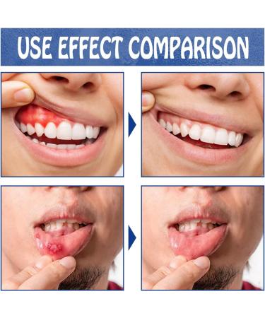 2pcs Toothache Relieving Spray Herbal Oralcare Spray Toothache Pain Relief Dental Pain Relief Spray Toothache Pain Relief for Adult Instant Teeth Treatment Relief Strong Pain Relief for Toothache - Buy Online on GoSupps.com