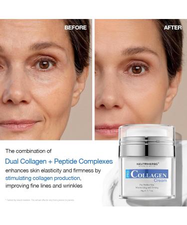 Neutriherbs Face Cream - Collagen Moisturizer for Black Spots & Fine Lines | 1.7OZ | International Shipping - Buy Online on GoSupps.com
