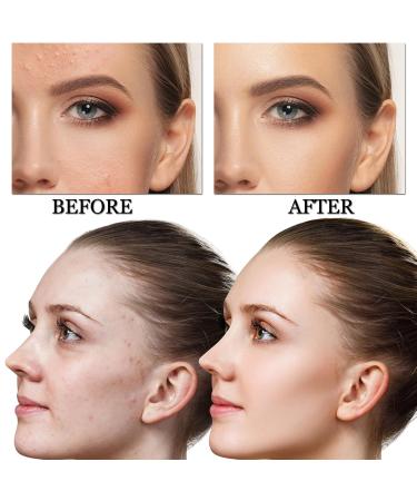 CAHIUYOA Mushroom Head Air Cushion CC Cream BB Cream Mushroom Head Foundation Full Coverage Foundation Makeup Long Lasting Moisturize Matte Concealer - 03 Medium - Buy Online on GoSupps.com