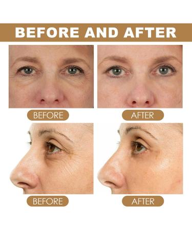 Retinol Eye Cream Eye Cream for Dark Circles and Puffy Eyes Eye Cream Anti Aging for Fade Dark Circles Under The Eyes and Moisturize Skin Anti Wrinkle Eye Cream for All Skin Types - Buy Online on GoSupps.com