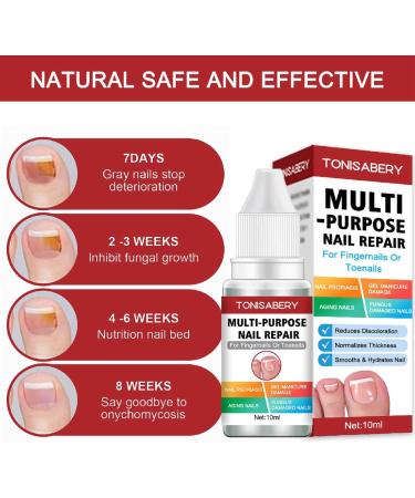 Fungal Nail Treatment Nail Fungus Treatment for Toenail Ingrown Toenail Treatment Toe Nail Fungal Treatment Fungal Nail Treatment for Toenails Extra Strong Nail Repair Treatment Repairing Broken Nail - Buy Online on GoSupps.com