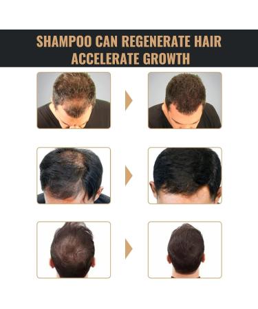 EXQST Spartan Shampoo - Spartan Root Revitalizing Shampoo Get Results in Just 6 Weeks - Buy Online on GoSupps.com