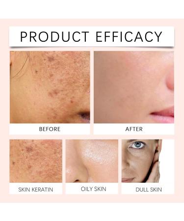  FUYOULILO Purifying Exfoliating Gel Purifying Facial Exfoliating Gel Purifying Exfoliating Gel for Deep Body Cleansing Brightening and Moisturizing (1 PCS) - Buy Online on GoSupps.com