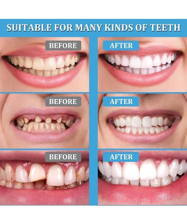 Perfect Smile Dentures Pebbles - Cosmetic Veneers & Temporary Prostheses for Men & Women | 6 Pairs of Reusable Tooth Whitener - Buy Online on GoSupps.com