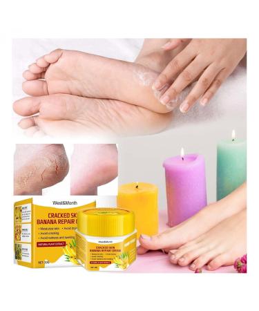 YUECI Moisturizing Horneut Care | Banana Repair Balm Foot Cream & Toe Nail Treatment - Repair Cracked Heels & Deep Moisturize - Size A - Buy Online on GoSupps.com