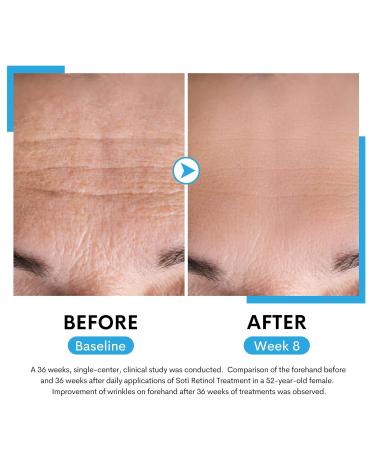 Soti 2.5% Retinol Serum - Anti-Aging Reduces Wrinkles & Age Spots Firm Skin with Hyaluronic Acid & Niacinamide - 60ml Made in USA - Buy Online on GoSupps.com