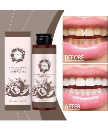 Coconut Oil Mouthwash Natural Coconut Oil Mouthwash For Whitening Teeth Freshens Breath Eliminates Bad Breath For Healthy Gums (1) - Buy Online on GoSupps.com