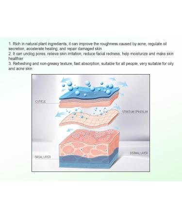 S rum visage anti-acn s rum r parateur texture l g re quilibre la peau formule non dess chante 2PCS - Buy Online on GoSupps.com
