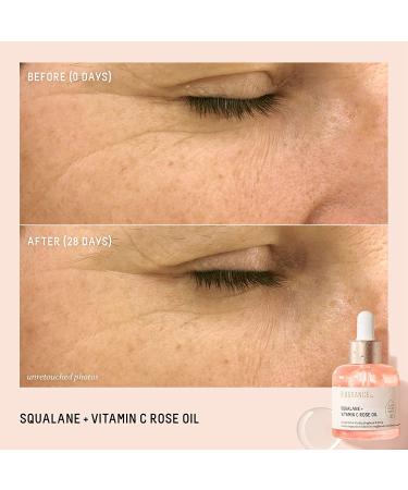 Biossance Squalane + Vitamin C Rose Oil - 1 Fl Oz Facial Oil for Brightening, Hydrating, Firming, and Radiant Skin - Buy Online on GoSupps.com