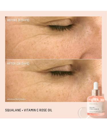 BIOSSANCE Vitamin C Rose Moisturizer + Vitamin C Rose Oil Bundle - Buy Online on GoSupps.com