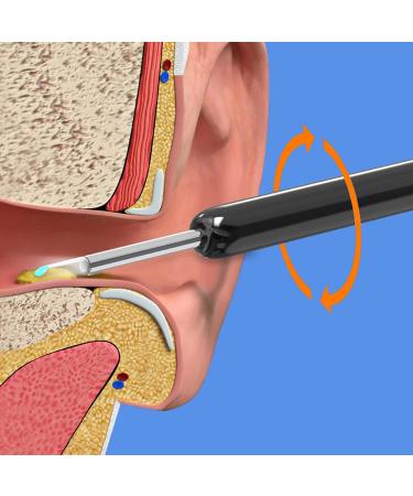 Wi-Fi Visible Ear Wax Removal Spoon - HD 1080P Endoscope Ear Cleaner Otoscope - USB Otoscope for Phones - Ear Wax Removal Kit (White) - Buy Online on GoSupps.com