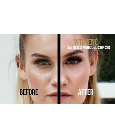 ADVANCED RETINOL and Hyaluronic Acid Silk Moisturiser | Caribbean SEA MOSS & COCONUT OIL | Anti Ageing | Face/Neck/Eye Area | LUXURIOUS Moisturising Vegan Cream - Buy Online on GoSupps.com