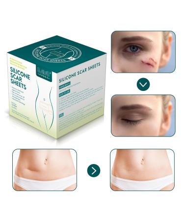 Silicone Scar Patch Roll - Professional Scar Removal Tape for Surgery, Burns, Keloid - 1.6 x 120 Roll - Buy Online on GoSupps.com