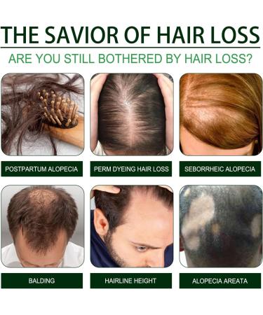 Organic Castor Oil Organic Black Castor Oil for Hair Growth Cold Pressed Castor Oil Promote Hair Growth Strengthen Hair Roots and Prevent Bifurcation 30ML - Buy Online on GoSupps.com