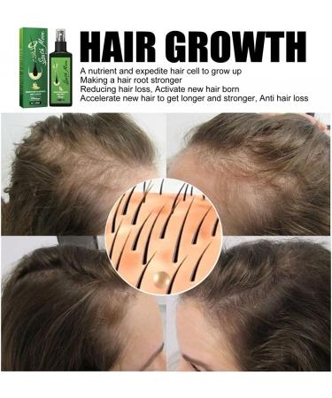 GrowthPlus Spray nourrissant au gingembre bio Growth Plus Spray nourrissant naturel pour cuir chevelu Spray nourrissant au gingembre pour homme et femme (1 pi ce) 1 pi ce. - Buy Online on GoSupps.com
