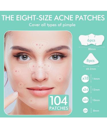Mandabloom Acne Patch with Tea Tree & Calendula Oil | 104 Dot & Nose/T-Zone Patches | Acne Absorbing Cover for Face, Chin, Body - Buy Online on GoSupps.com
