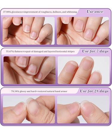 3 Pi ces Nail Care Pen Huile Cuticules Ongles Stylo 3 en 1 Stylos Huile pour Cuticules Embout en C ramique Stylo Ongles Hydratant pour Am liorer l'aspect des Petites Peaux et Exfolier - Buy Online on GoSupps.com