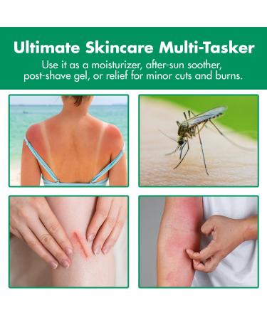 Aloe Relief 99% Pure Aloe Vera Gel Hydrating & Soothing After Sun Care Natural Aloe Gel for Face & Body Fast Absorbing & Non-Sticky Formula Ideal for Dry Skin Sunburn Relief & Irritation 12 oz - Buy Online on GoSupps.com