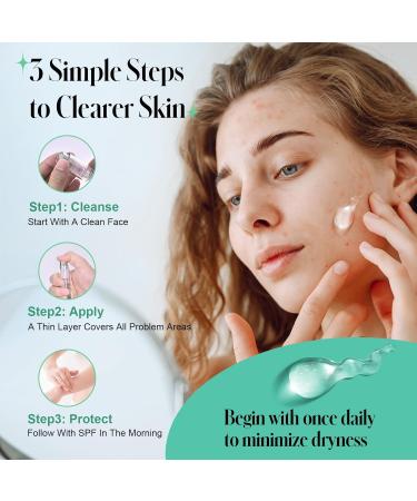 TRSTAY LUXE Acne Treatment Serum with 2% Salicylic Acid Clarifying Acne Gel for Face, Helps Treat Acne Blemishes, Reduce Redness & Control Oil Daily Acne Care for Men & Women (10ml) - Buy Online on GoSupps.com