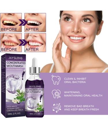 Concentrated Mouthwash for Fresh Breath & Whiter Teeth | Clean Stains & Remove Yellowing - International Shipping Available - Buy Online on GoSupps.com