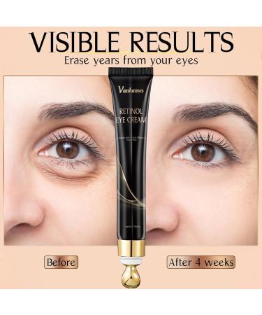 Retinol Caffeine Eye Cream - Anti-Aging Under Eye Treatment for Dark Circles & Puffiness Fragrance Free 20g - Buy Online on GoSupps.com