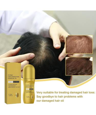 Huile de cheveux Damaged Hair Oil Scalp Oil for Hair Growth Hair Thickening Oil for Men Rollerball Hair Oil for Growth Scalp Oil Hair Moisturizer for Thickening - Buy Online on GoSupps.com