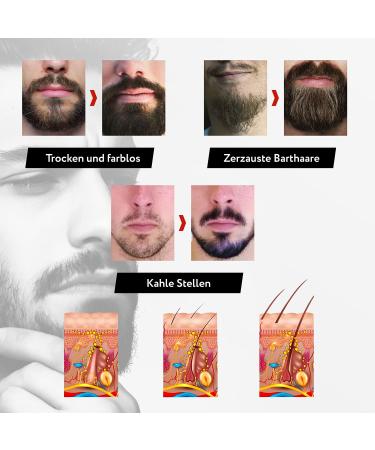 Premium Bart Set - Complete Beard Care Kit | Includes Bart Balsam Bart l & Bartshampoo | Perfect Gift for Men | International Shipping Available - Buy Online on GoSupps.com