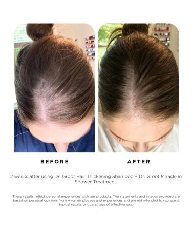 Dr. Groot Scalp Revitalizing Solution Travel Set | Hair Thickening Shampoo & Treatment | TSA Approved Korean Hair Care with Rosemary Oil - Buy Online on GoSupps.com