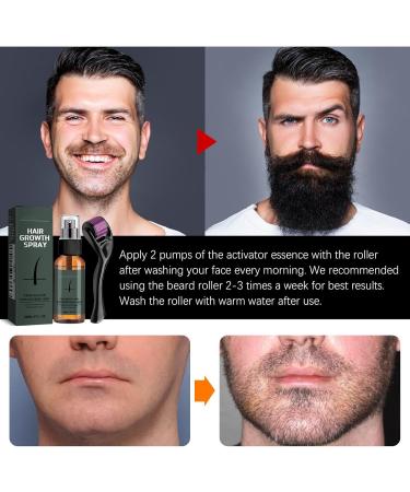 Derma Roller Hair Growth Hair Growth Spray Beard Roller for Growth 540 0.5MM Titanium Needles Beard Roller For Growth For Men Stimulate Beard & Hair Growth/Microneedle Roller(Roller Set) - Buy Online on GoSupps.com