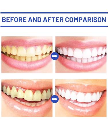 Teeth Whitening Powder for 3 Days White Teeth | Teeth Whitening | Visible Cleaning Effect | Teeth Whitener - Cosmetic Teeth Cleaning (2) - Buy Online on GoSupps.com
