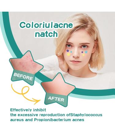 112 Counts Star-Shaped Pimple Patches - Hydrocolloid Acne Stickers for All Skin Types - Effective Pimple Patch Set - Buy Online on GoSupps.com
