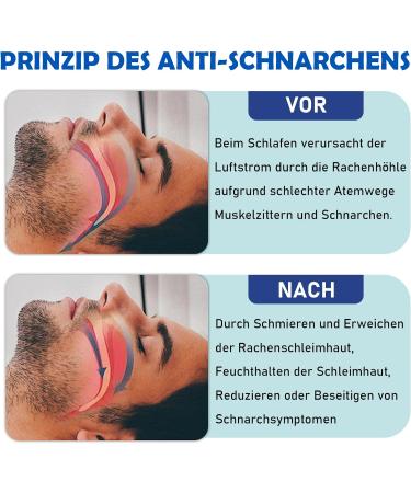 Snor-Stopper Mouthpiece | Anti-Snore Rail & Bite Protection | Sleep Better with Teeth Grinding Relief - Blue - Buy Online on GoSupps.com