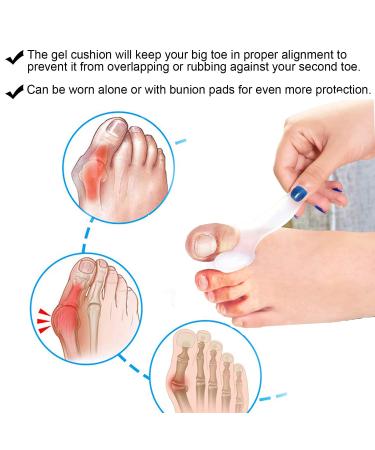 McVcoyh 8-Piece Toe Bale Cushions & Gel Sign Set | Pain Relief for Large Toe Joint | Toe Correction Spacers - Buy Online on GoSupps.com