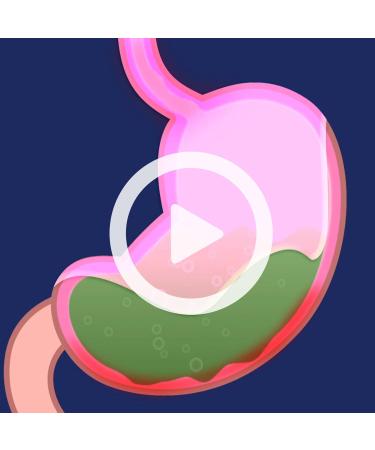 Pepto Bismol Original Liquid 5 Symptom Medicine - Including Upset Stomach and Diarrhea Relief 8 oz (Packaging May Vary) 8 Fl Oz (Pack of 1) - Buy Online on GoSupps.com