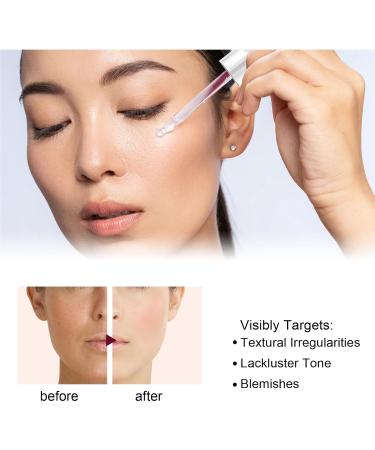 Acid Refining Serum Acid Delicate Essence 2% High-Strength Vitamin Minimises Pore Face Serum Pore Smoothing Fruit Acid Essence - Buy Online on GoSupps.com