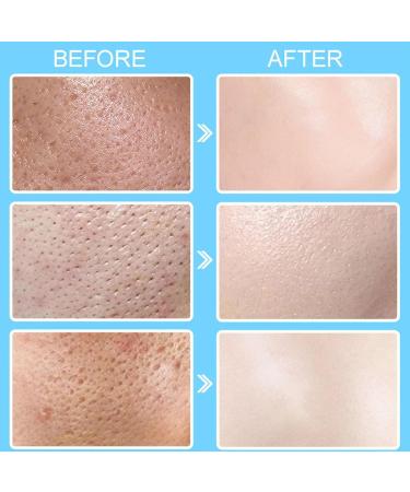 ARCHIDATE Pore Invisible Cream Minimize Pores on Face Long-lasting Deep Hydration Smooth Skin Texture Oil Control Reduce Fine Lines Lightweight Non-Greasy Pore Shrinking Invisibility Cream - Buy Online on GoSupps.com