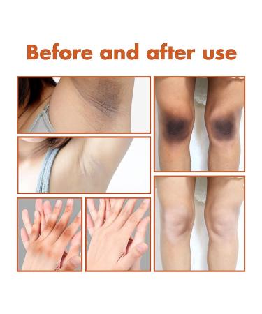 Purer Feminine Intimate Area Whitening Essence Cream Set - Exfoliation, Lightening, and Moisturizing (3Pcs) - Buy Online on GoSupps.com