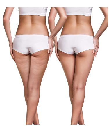 LuxeJoie Cellulite Recovery Cream 21-Day Challenge for Booty, Hips & Thighs - 4oz - Buy Online on GoSupps.com